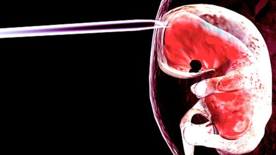 Scientists use ‘pregnancy fluid’ to strengthen weak bones