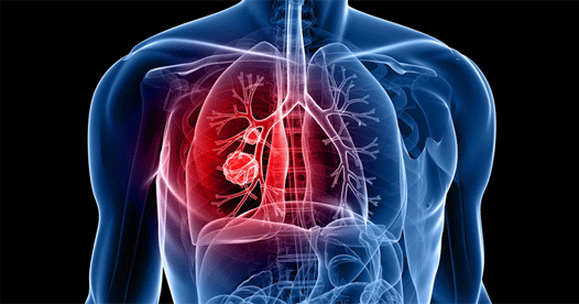 Scientists successfully grow three-dimensional lungs in lab using stem cells